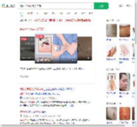 被蚊子咬后发热关节痛_360搜索