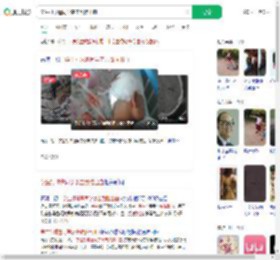 学生打球遭同学袭击致脑出血_360搜索